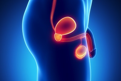 Tips to Preventing Prostate Cancer