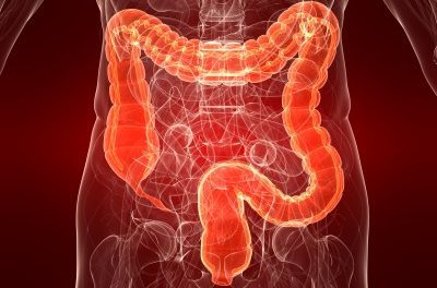 Keeping your colon constipation and cancer free