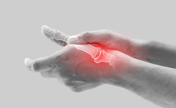 What foods cause arthritis pain