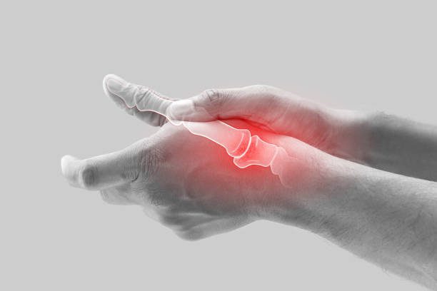What foods cause arthritis pain