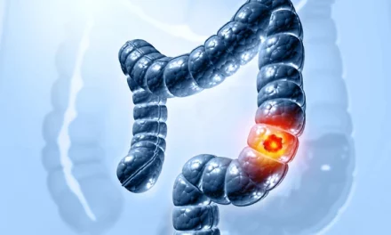 Truth about colon cancer