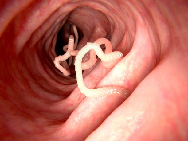Beware intestinal parasites