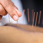 Get to the point with acupuncture