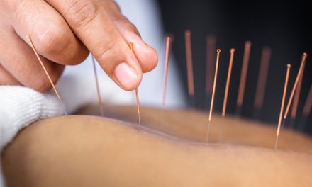 Get to the point with acupuncture