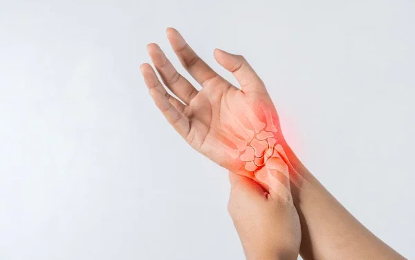 Carpal Tunnel Syndrome