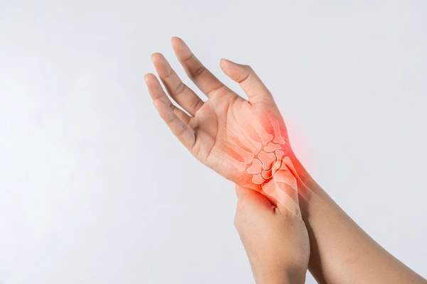 Carpal Tunnel Syndrome