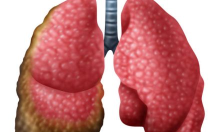 Mesothelioma