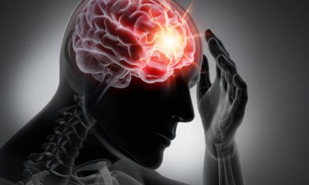 head Concussion issues