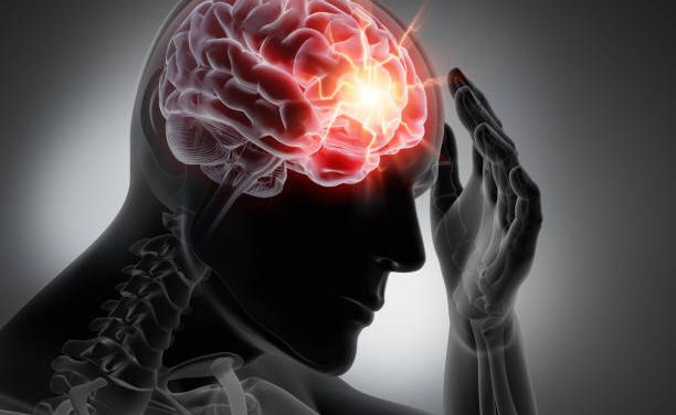 head Concussion issues