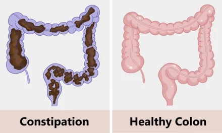 Cleansing Your Colon Naturally