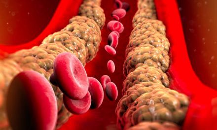 Why too much cholesterol is bad
