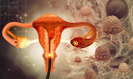 Endometriosis