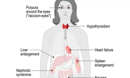 about Amyloidosis