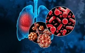 pneumonia, community-acquired pneumonia, CAP, hospital-acquired pneumonia, HAP, ventilator-associated pneumonia, VAP, atypical pathogens, Streptococcus pneumoniae, Haemophilus influenzae, Staphylococcus aureus, MRSA, Pseudomonas aeruginosa, Legionella, Mycoplasma, Chlamydia pneumoniae, viral pneumonia, influenza, RSV, SARS-CoV-2, aspiration pneumonia, anaerobes, risk factors, elderly, pediatrics, immunocompromised, fever, cough, dyspnea, pleuritic chest pain, sputum, hypoxia, crackles, chest X-ray, ultrasound lung, CT chest, procalcitonin, CURB-65, PSI score, blood cultures, sputum culture, empiric antibiotics, macrolide, doxycycline, beta-lactam, fluoroquinolone, de-escalation, steroid use selective, oxygen therapy, complications, parapneumonic effusion, empyema, prevention, vaccination