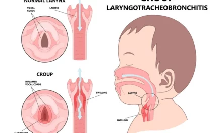 about Croup