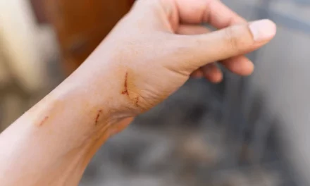 about Cat Scratch Fever disease