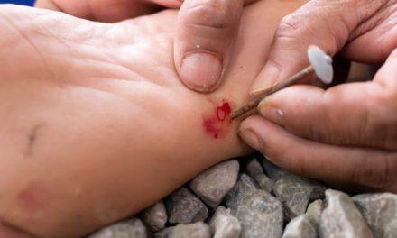about Tetanus