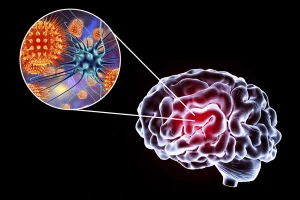 encephalitis, viral encephalitis, autoimmune encephalitis, HSV-1, HSV-2, varicella zoster virus, enteroviruses, arboviruses, West Nile virus, Japanese encephalitis, tick-borne encephalitis, rabies, NMDA receptor encephalitis, LGI1 encephalitis, paraneoplastic, fever, headache, altered mental status, seizures, focal neurologic deficits, photophobia, CSF pleocytosis, PCR diagnostics, MRI temporal lobe hyperintensity, EEG abnormalities, acyclovir, ganciclovir, foscarnet, corticosteroids, IVIG, plasmapheresis, immunotherapy, empiric antibiotics, ICU care, airway protection, hyponatremia (SIADH), cerebral edema, herniation risk, rehabilitation, cognitive sequelae, memory impairment, pediatric cases, elderly patients, immunocompromised hosts, vaccination prevention, mosquito control, tick precautions, travel medicine, post-infectious ADEM, differential diagnosis, lumbar puncture