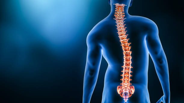 about Scoliosis