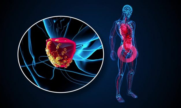 Keep Prostate Cancer At Bay