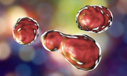 Fungal Meningitis Found in Contaminated Steroid Injections