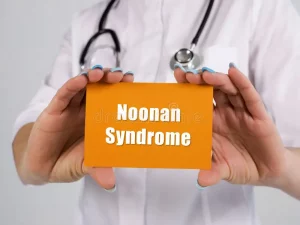 Noonan syndrome, RASopathy, PTPN11, SOS1, RAF1, RIT1, KRAS, NRAS, BRAF, MAP2K1, SHOC2, LZTR1, autosomal dominant, de novo variants, short stature, webbed neck, pectus deformity, hypertelorism, downslanting palpebral fissures, low-set posteriorly rotated ears, congenital heart disease, pulmonary valve stenosis, hypertrophic cardiomyopathy, atrial septal defect, bleeding diathesis, factor XI deficiency, platelet dysfunction, lymphatic dysplasia, lymphedema, cryptorchidism, delayed puberty, fertility considerations, developmental delay, learning difficulties, feeding difficulties, failure to thrive, hearing loss, recurrent otitis media, scoliosis, renal anomalies, increased nuchal translucency, cystic hygroma, prenatal ultrasound markers, genetic testing panel, cascade testing, growth hormone therapy, physical therapy, speech therapy, multidisciplinary care, surveillance guidelines