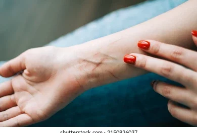 A Serious Cry For Help