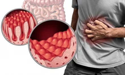 about Celiac Disease