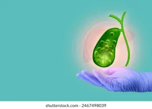 gallstones, cholelithiasis, cholesterol stones, pigment stones, black pigment stones, brown pigment stones, biliary colic, right upper quadrant pain, postprandial pain, nausea, vomiting, jaundice, choledocholithiasis, acute cholecystitis, chronic cholecystitis, gallstone pancreatitis, biliary obstruction, ascending cholangitis, Charcot triad, Reynolds pentad, ultrasound, sonographic Murphy sign, gallbladder wall thickening, pericholecystic fluid, HIDA scan, MRCP, ERCP, endoscopic sphincterotomy, common bile duct stone, laparoscopic cholecystectomy, open cholecystectomy, ursodeoxycholic acid, female sex, age over 40, obesity, rapid weight loss, pregnancy, diabetes mellitus, hemolysis, sickle cell disease, Crohn’s ileal disease, bariatric surgery, ceftriaxone therapy, estrogen therapy, fibrates, metabolic syndrome, low-fat diet, recurrence prevention, bile sludge, porcelain gallbladder
