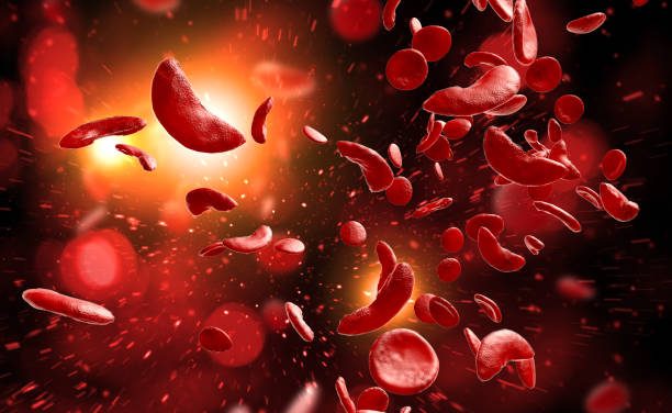 about Sickle Cell Disease