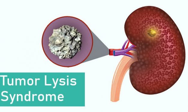 about Tumor Lysis Syndrome
