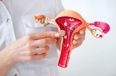 about Uterine Fibroids