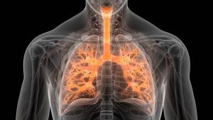 pulmonary fibrosis, idiopathic pulmonary fibrosis, IPF, interstitial lung disease, ILD, dyspnea, dry cough, bibasilar crackles, clubbing, hypoxemia, exertional desaturation, DLCO reduction, restrictive spirometry, HRCT, honeycombing, ground-glass opacities, usual interstitial pneumonia, UIP, nonspecific interstitial pneumonia, NSIP, autoimmune-associated ILD, connective tissue disease, scleroderma lung disease, rheumatoid arthritis ILD, hypersensitivity pneumonitis, sarcoidosis, pneumoconiosis, asbestosis, silicosis, smoking history, aging risk, gastroesophageal reflux, microaspiration, oxygen therapy, pulmonary rehabilitation, antifibrotics, nintedanib, pirfenidone, lung transplant, six-minute walk test, FVC decline, GAP index, acute exacerbation, palliative care, cough management, vaccination, comorbidities, sleep apnea, pulmonary hypertension, clinical trials