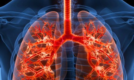 about Pulmonary Fibrosis