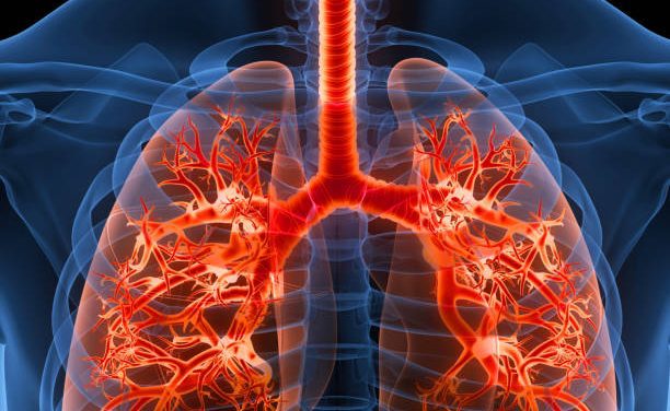 about Pulmonary Fibrosis