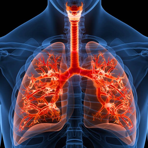 about Pulmonary Fibrosis
