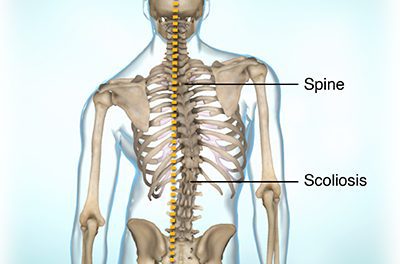 Friedreich’s Ataxia