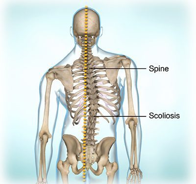 Friedreich’s Ataxia