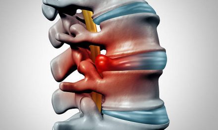 Herniated Disc