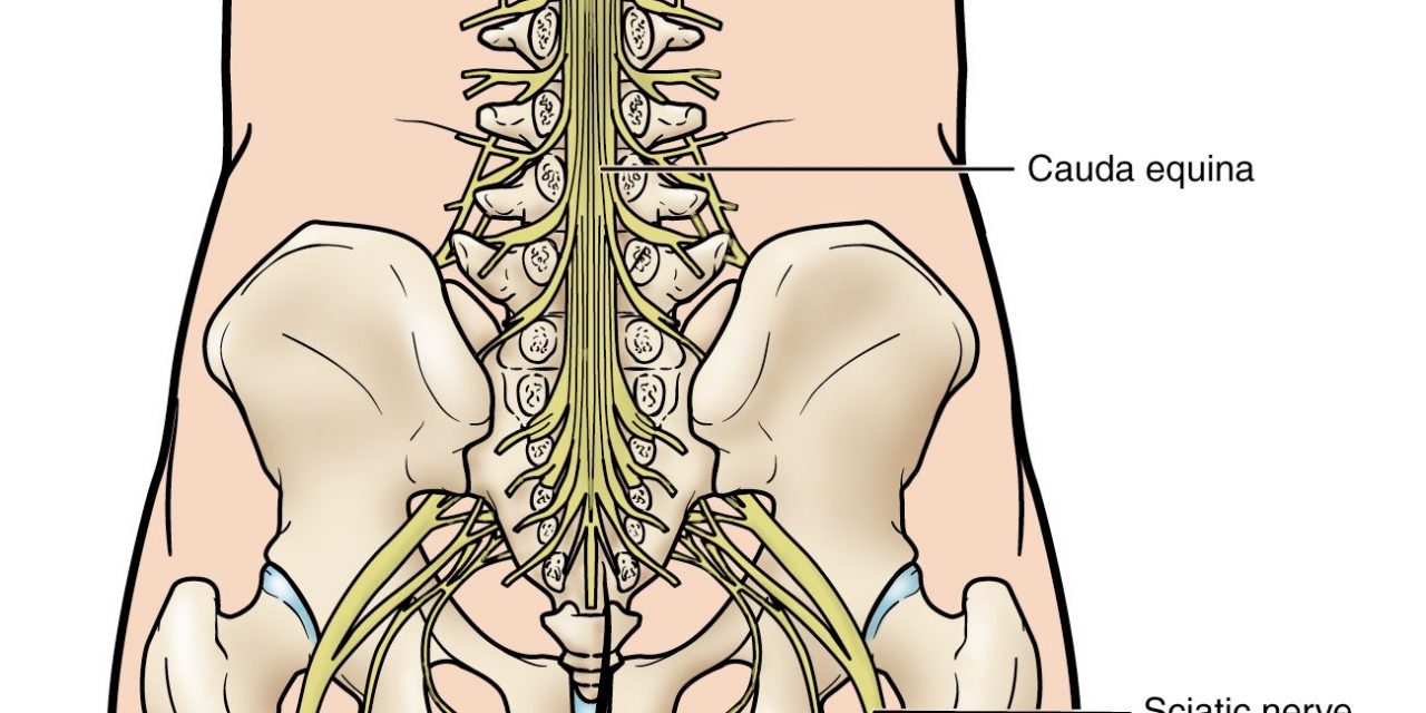 Cauda Equina Syndrome