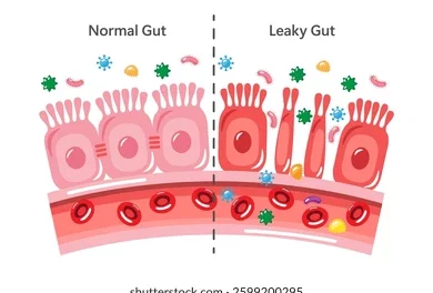 Do You Have A Leaky Gut?