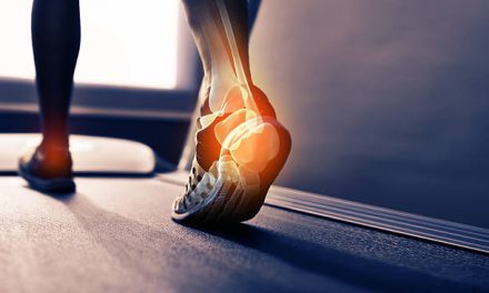 How to Recover From a Foot Injury
