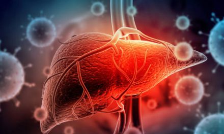 Managing Your Liver Disease Naturally
