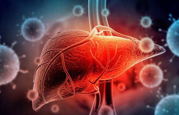 Managing Your Liver Disease Naturally