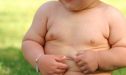 Childhood Obesity