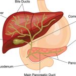 Primary Biliary Cirrosis