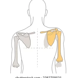 How To Fix Muscle Imbalances